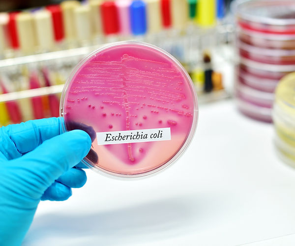 Pathogen Escherichia Coli