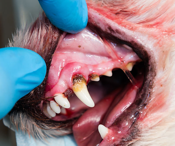 The image above depicts the plaque formation and gum inflammation associated with periodontitis.