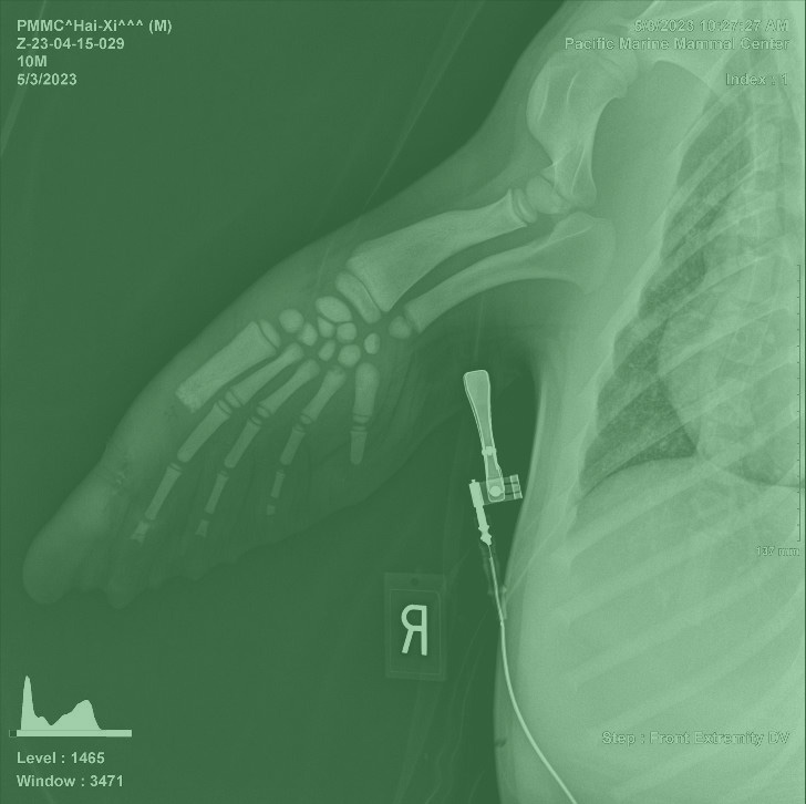 midog case report