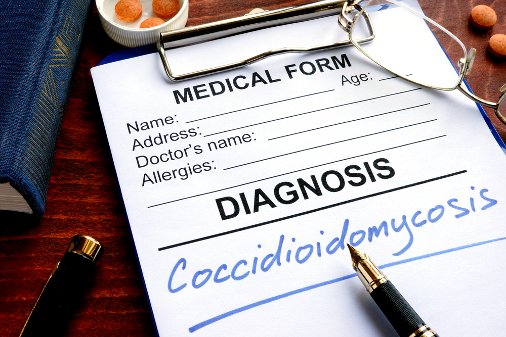 valley fever diagnosis