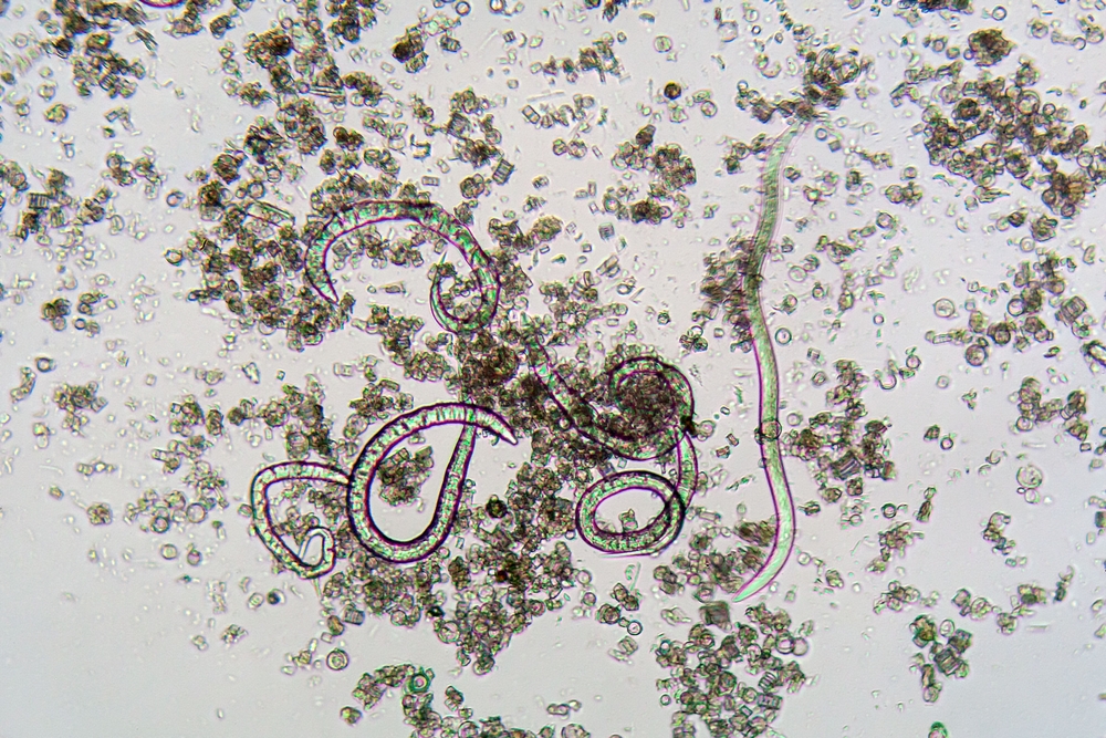 Microscopic image showing parasitic helminths within a clinical sample, representing organisms that may be difficult to detect using traditional diagnostic methods.
